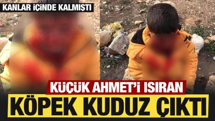 Adıyaman'da küçük Ahmet'i ısıran köpek kuduz çıktı