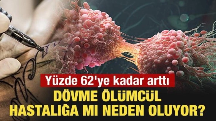 Dövme ölümcül hastalığa mı yol açıyor? Yüzde 62'ye kadar arttı